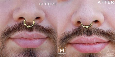 septum piercing hurt|septum piercings before and after.